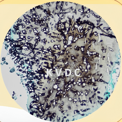 GMS Stain ภาพขวา