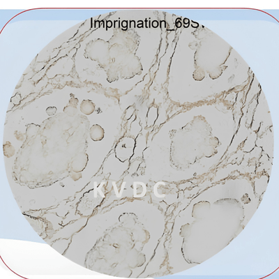 Silver Impregnation ภาพขวา